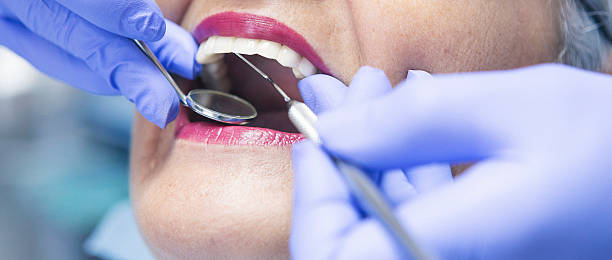 Best Knocked-Out Tooth Emergency  in Red Bank, TN